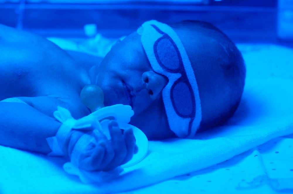 Os hospitais ainda não humanizaram a fototerapia em recém-nascidos