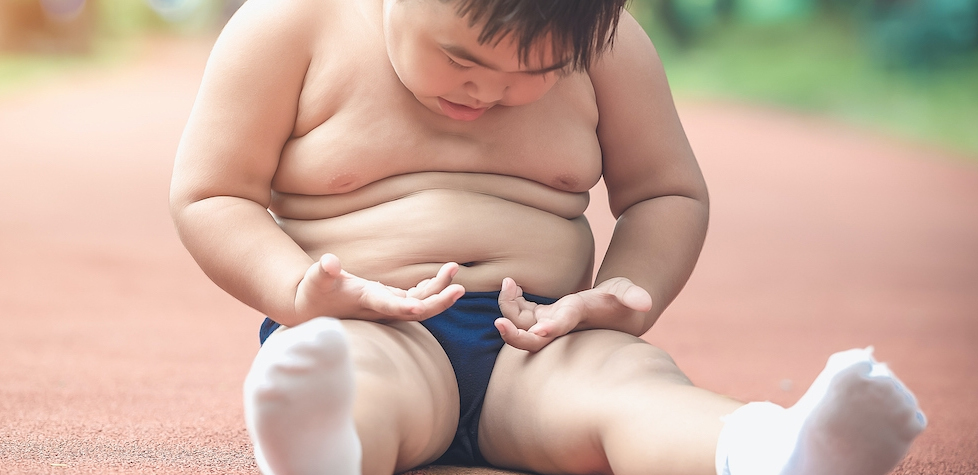 Número de crianças com obesidade pode chegar a 75 milhões até 2025