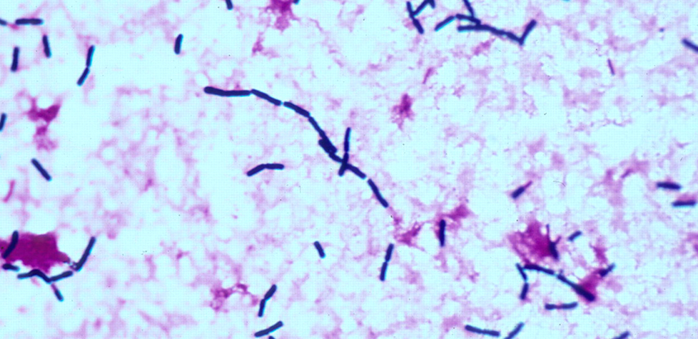 A contaminação de alimentos pelo Bacillus cereus