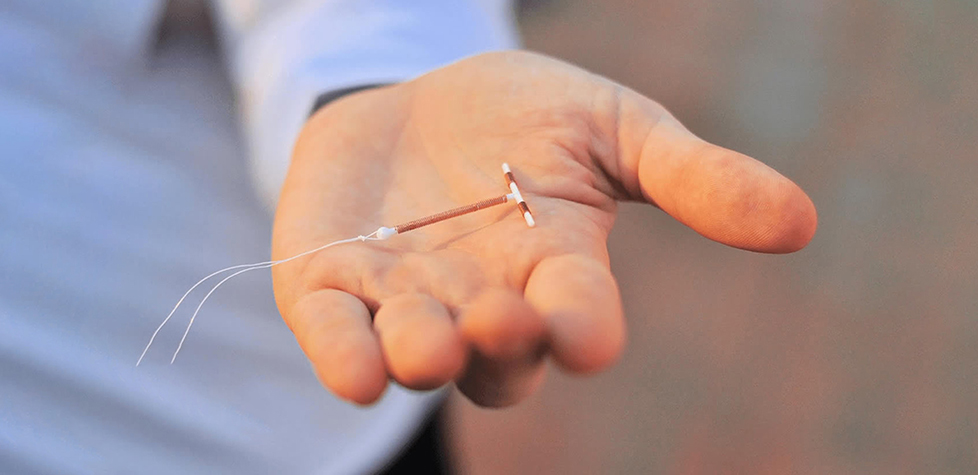 A Qualidade dos dispositivos anticoncepcionais intrauterinos de cobre