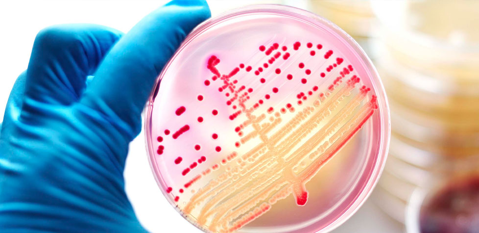 A contagem e a detecção de bactérias mesófilas aeróbicas em cosméticos