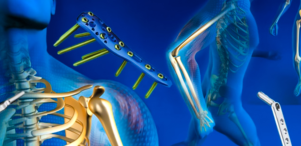 As especificações normativas para os dispositivos de fixação da coluna vertebral
