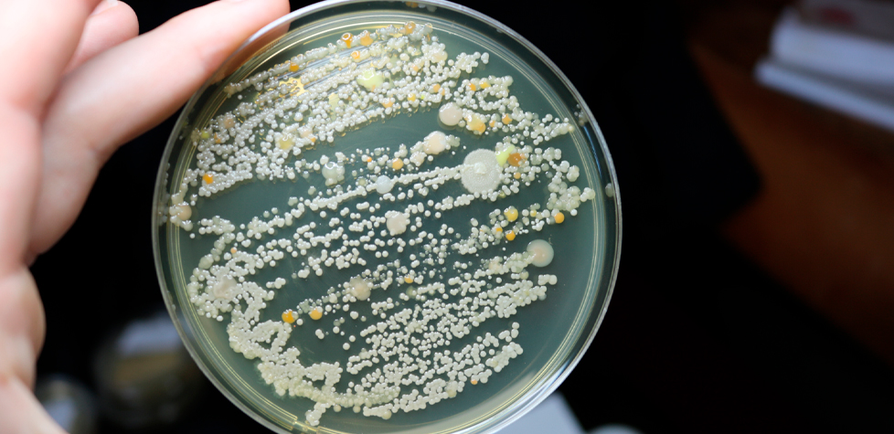 A detecção do micro-organismo Pseudomonas aeruginosa em produtos cosméticos