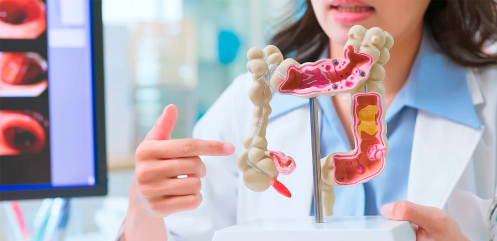 As diretrizes terapêuticas do tumor do estroma gastrointestinal