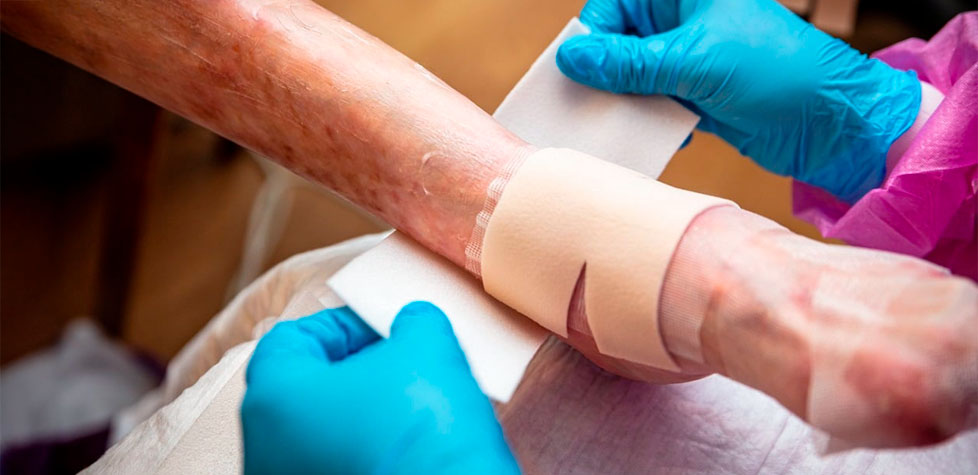 Os cuidados dos pacientes com epidermólise bolhosa
