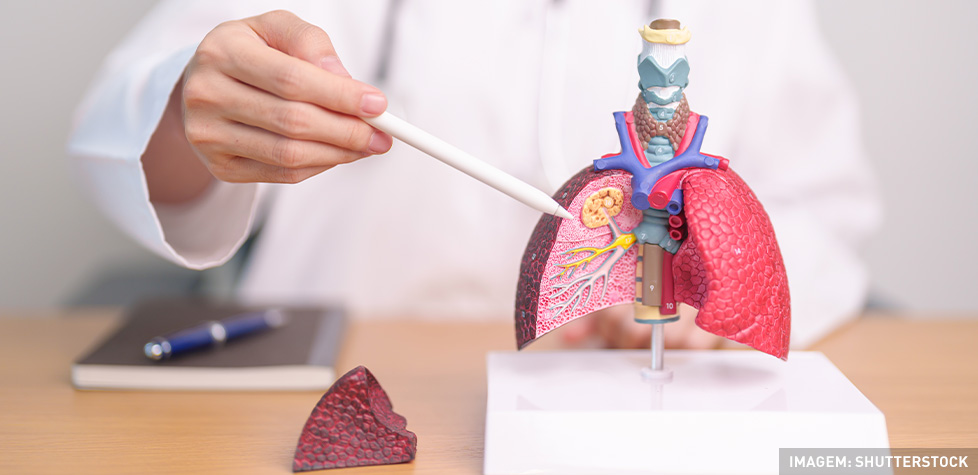 A caracterização da doença pulmonar obstrutiva crônica