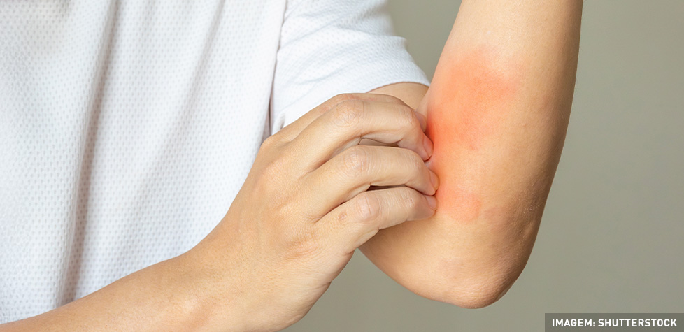 A avaliação dos dispositivos médicos sobre o seu potencial de produzir irritação