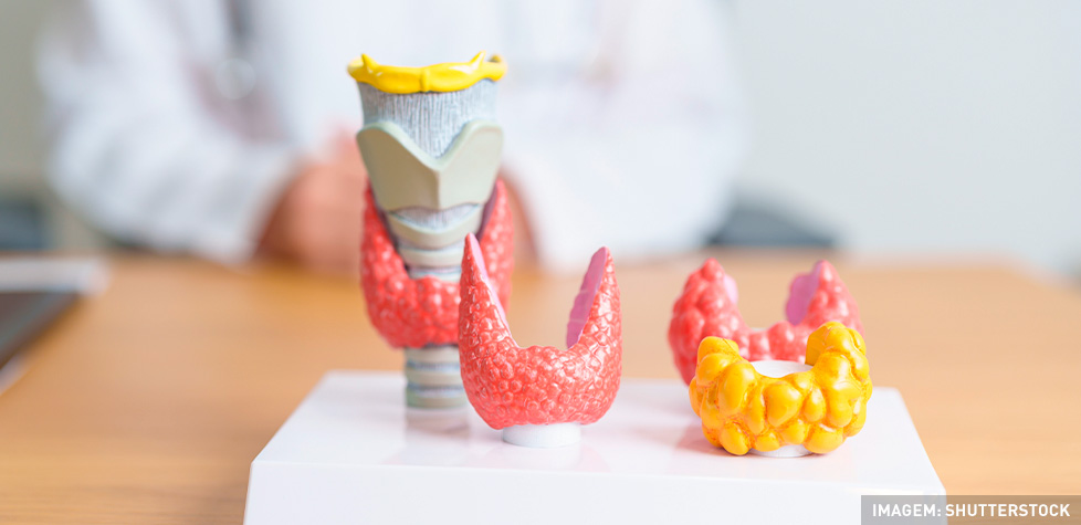 A disfunção na tireoide denominada hipotireoidismo