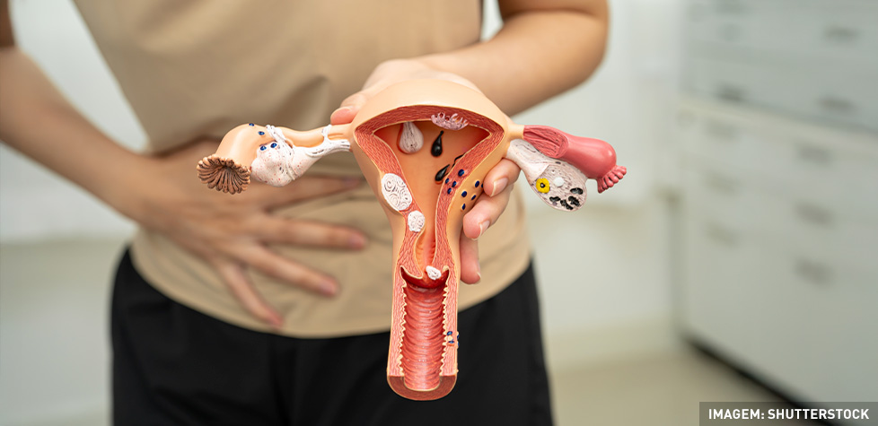 Os sintomas mais comuns da tricomoníase