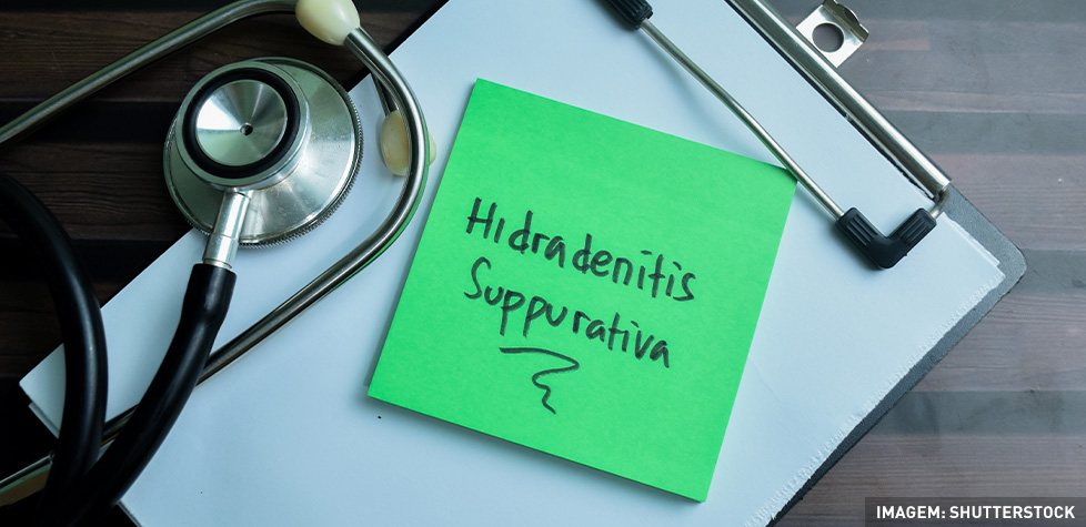 As diretrizes terapêuticas da hidradenite supurativa