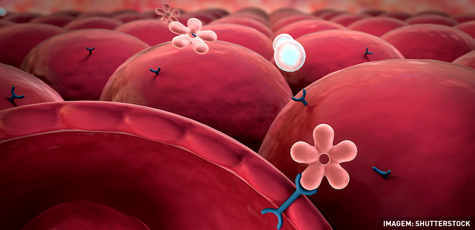 O quadro clínico da hemoglobinúria paroxística noturna