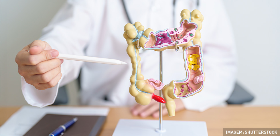 As condições médicas da diverticulite