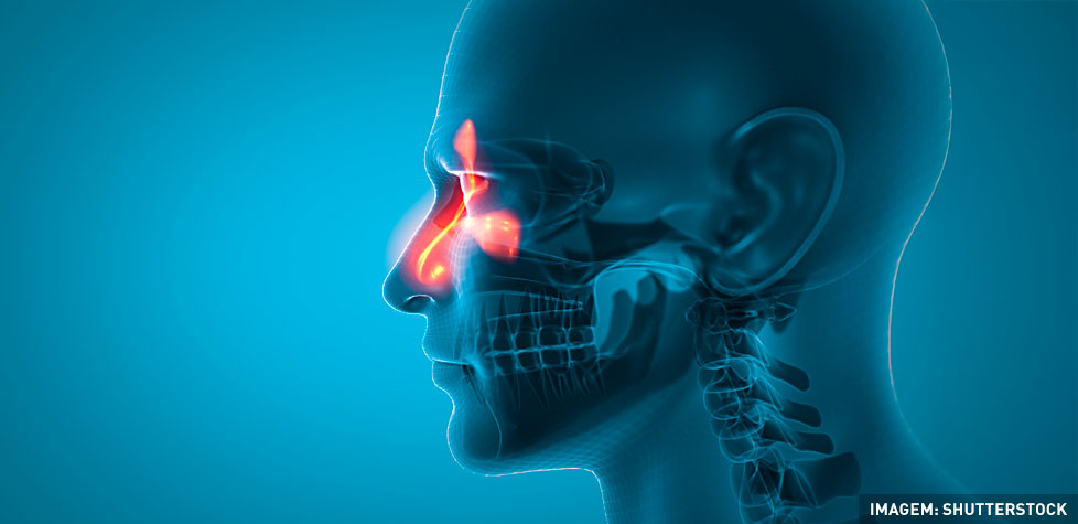 As causas médicas e clínicas da sinusite