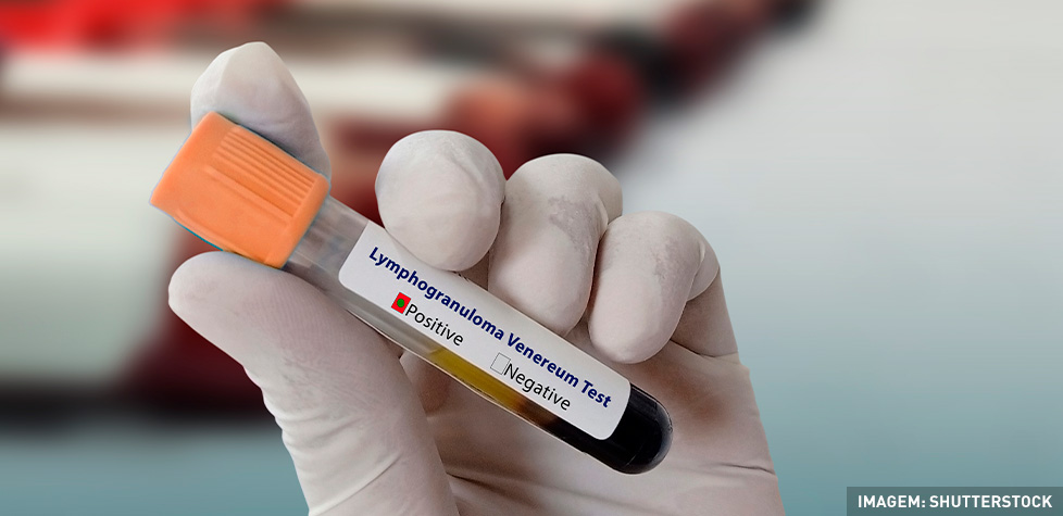 As causas e a prevenção do linfogranuloma venéreo