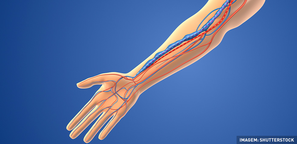 A fístula exige cuidados médicos