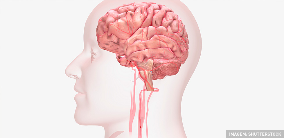 O distúrbio neurológico chamado ataque isquêmico transitório