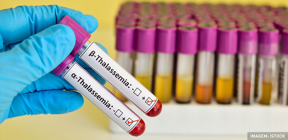 Os tipos de talassemia ou anemia hereditária