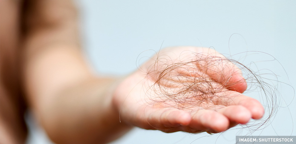 A queda de cabelo pode necessitar de ajuda profissional