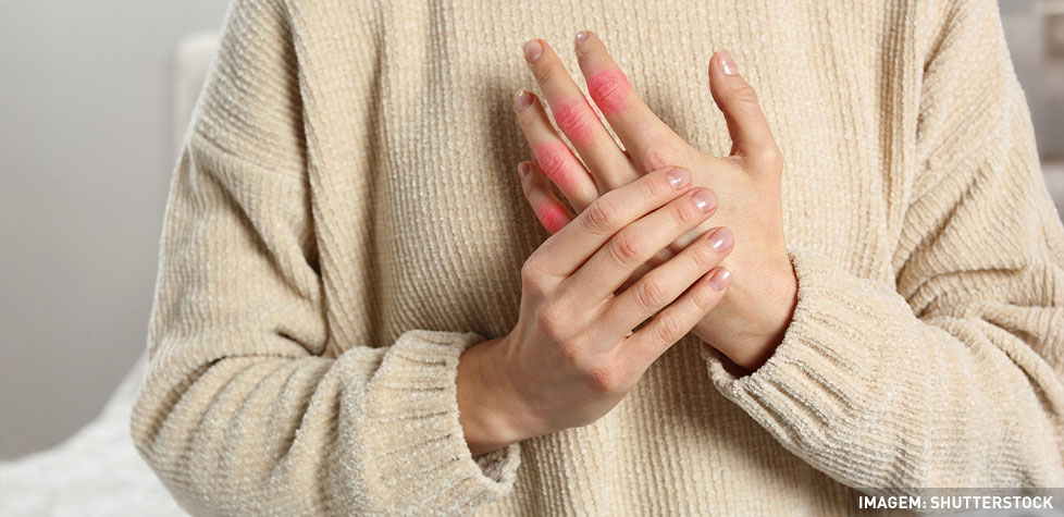 As características médicas da gota ou artrite gotosa