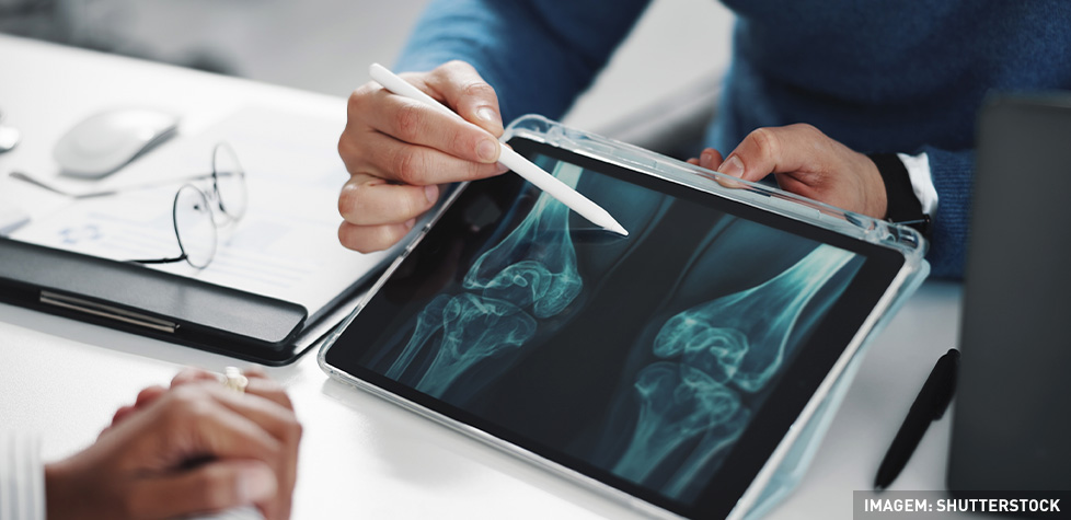 A importância da saúde óssea para prevenir a osteoporose