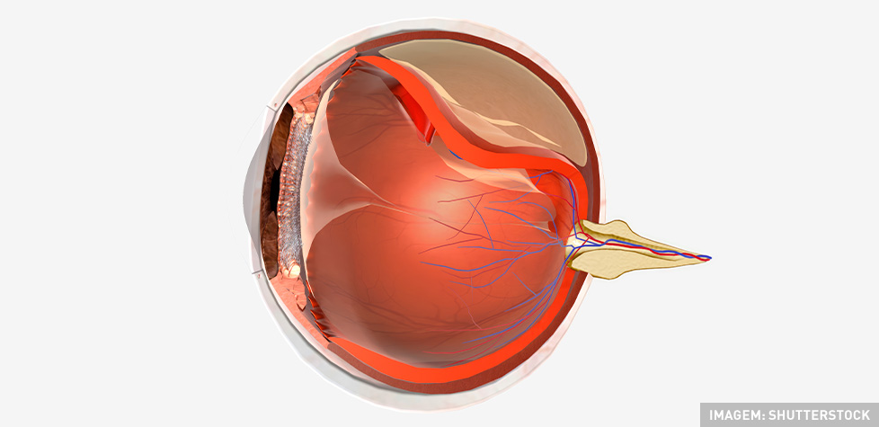 As condições clínicas do descolamento da retina