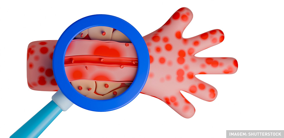 As causas médicas da vasculite