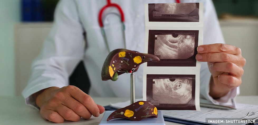 As causas médicas da cirrose hepática