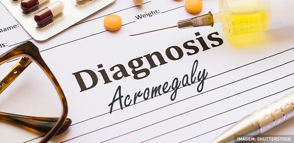 As causas médicas da acromegalia