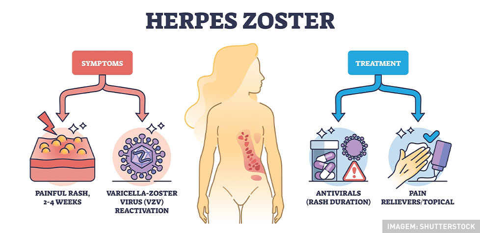 As causas clínicas herpes-zóster